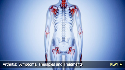 Arthritis: Symptoms, Therapies and Treatments