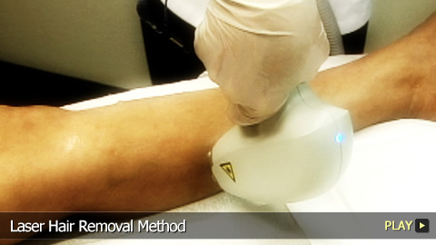 Laser Hair Removal Method