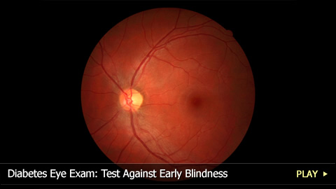 Diabetes Eye Exam: Test Against Early Blindness