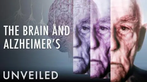 What Happens To The Brain During Alzheimer's?