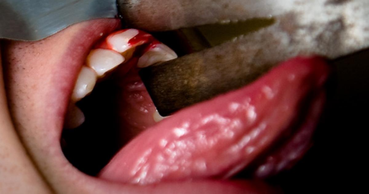 Bleeding Mouth Porn - Bleeding Torture Porn | BDSM Fetish