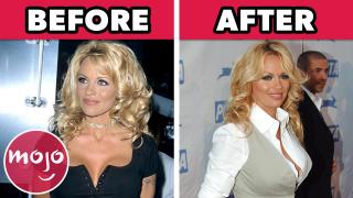 Top 20 Celebrities Who Regret Their Plastic Surgery