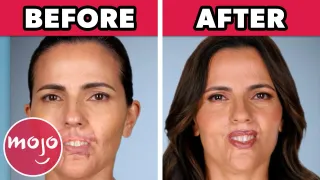 Top 10 Craziest Transformations on Botched