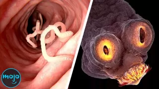 Top 10 Grossest Parasites (And What They Do To Your Body) 